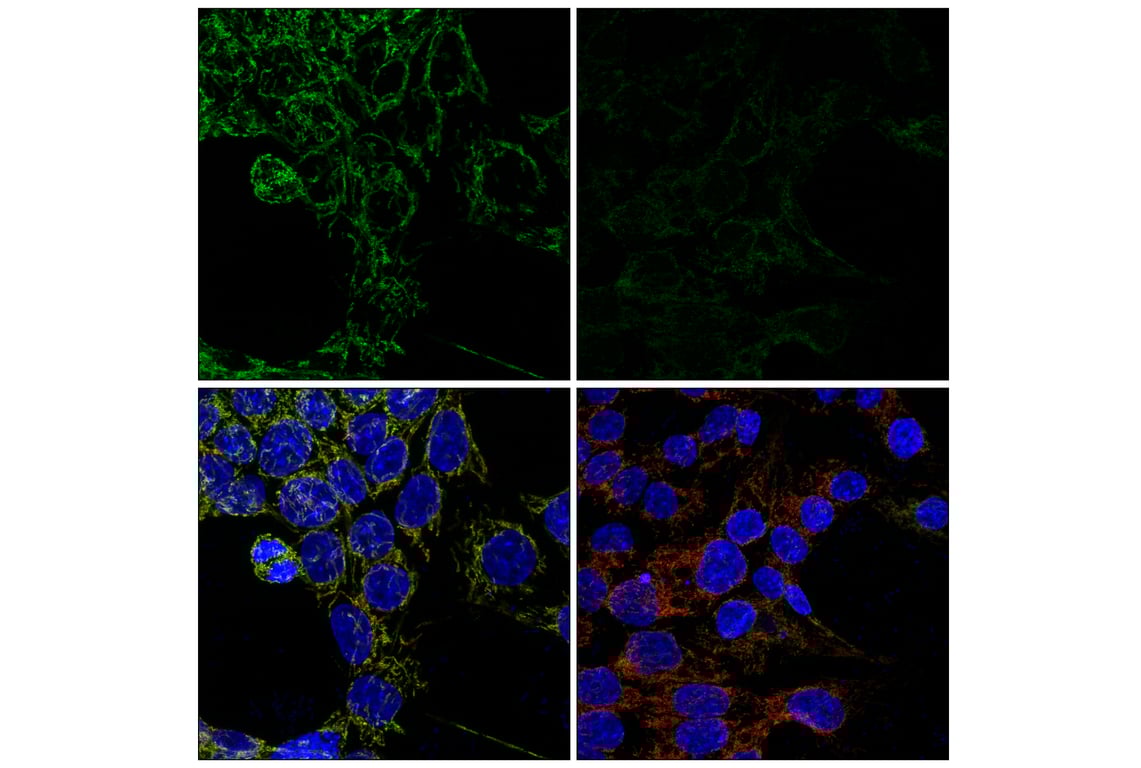 Immunofluorescence Image 1: TOM70 (E7E1M) Rabbit Monoclonal Antibody
