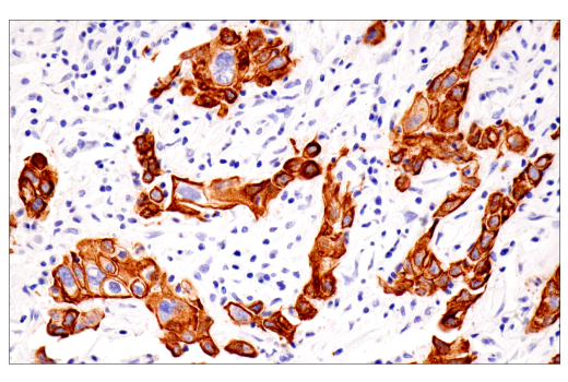 Immunohistochemistry Image 2: Pan-Keratin (5D3/LP34) Mouse Monoclonal Antibody