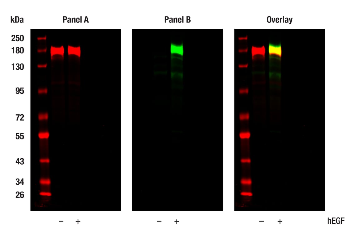 Western Blotting Image 1: Phospho-EGF Receptor (Tyr998) (C24A5) Rabbit Monoclonal Antibody