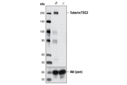 Western Blotting Image 2: Tuberin/TSC2 (D93F12) Rabbit Monoclonal Antibody (BSA and Azide Free)