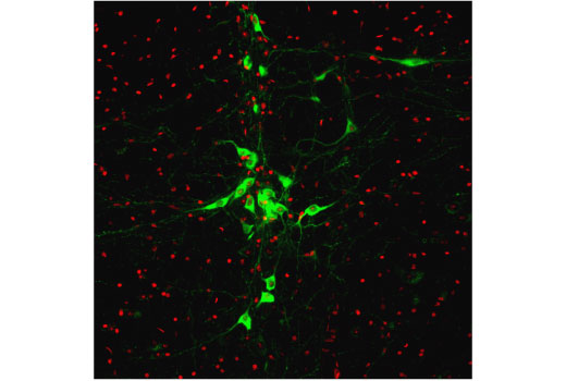 Immunofluorescence Image 1: TPH2 (D3E5I) Rabbit Monoclonal Antibody