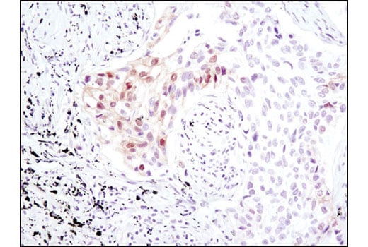 undefined Image 17: Hippo Signaling Antibody Sampler Kit