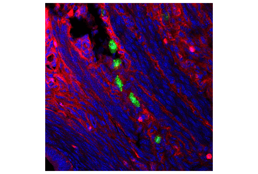 Immunofluorescence Image 1: Granzyme B (D2H2F) Rabbit Monoclonal Antibody (BSA and Azide Free)