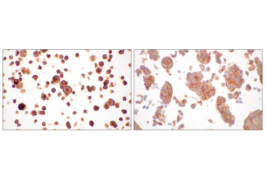 Immunohistochemistry Image 4: CMTM6 (E6A8T) Rabbit Monoclonal Antibody