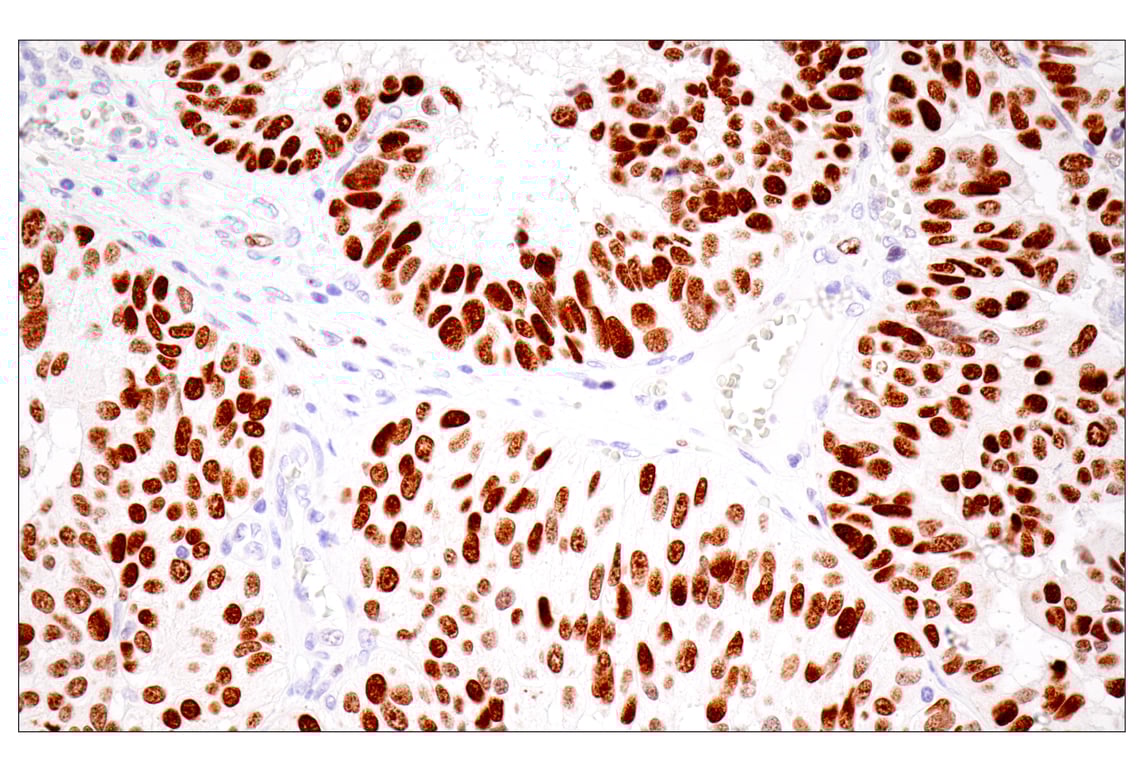 Immunohistochemistry Image 1: UHRF1 (E5W8W) Rabbit Monoclonal Antibody