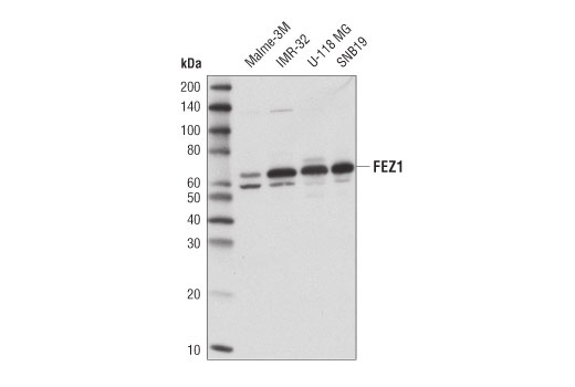 Western Blotting Image 4: FEZ1 (D9R8Q) Rabbit Monoclonal Antibody