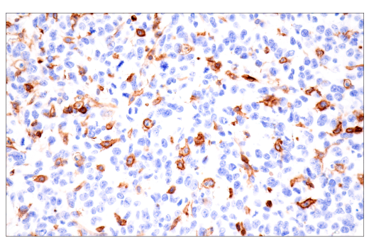 Immunohistochemistry Image 3: CD38 (E9F5A) Rabbit Monoclonal Antibody