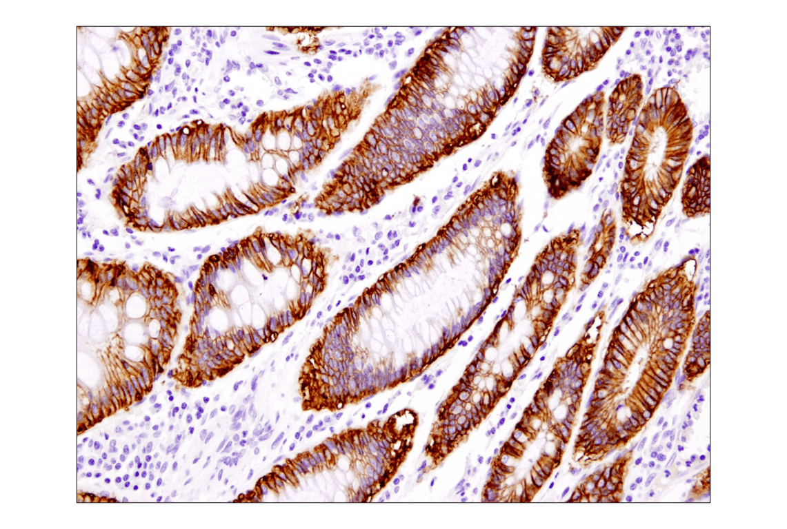 Immunohistochemistry Image 2: EpCAM (D9S3P) Rabbit Monoclonal Antibody