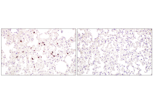 Immunohistochemistry Image 7: Neutrophil Elastase (E8U3X) Rabbit Monoclonal Antibody