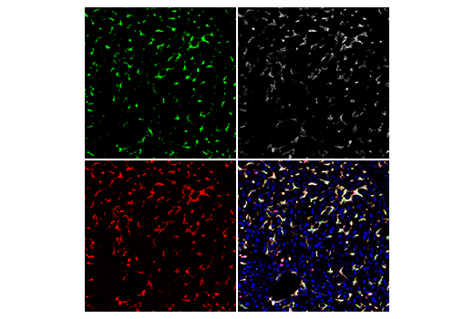 Immunofluorescence Image 2: TIPE2 (E5Q2S) Rabbit Monoclonal Antibody