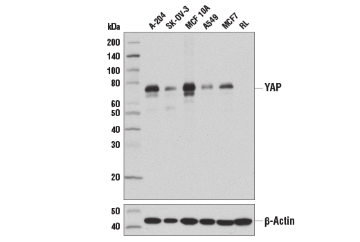 Western Blotting Image 2: YAP (D8H1X) Rabbit Monoclonal Antibody