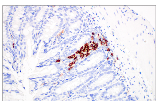 Immunohistochemistry Image 3: CD20 (E3N7O) Rabbit Monoclonal Antibody (BSA and Azide Free)
