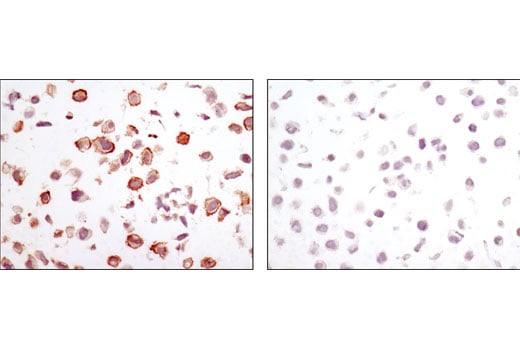 Immunohistochemistry Image 2: CA9 (D47G3) Rabbit Monoclonal Antibody (BSA and Azide Free)