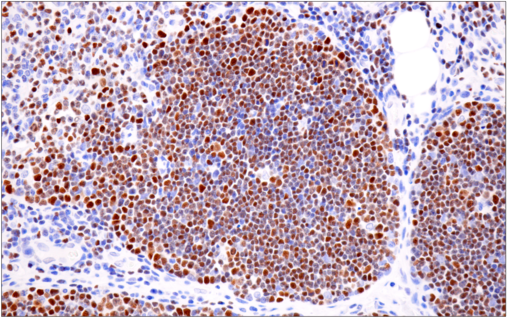 Immunohistochemical analysis of paraffin-embedded human tonsil using CD19 (Intracellular Domain) (D4V4B) XP<sup>®</sup> Rabbit mAb.