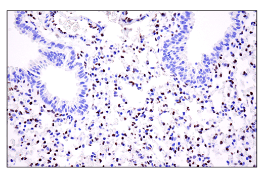 ZEB1 (E2G6Y) XP® Rabbit mAb (BSA and Azide Free) | Cell