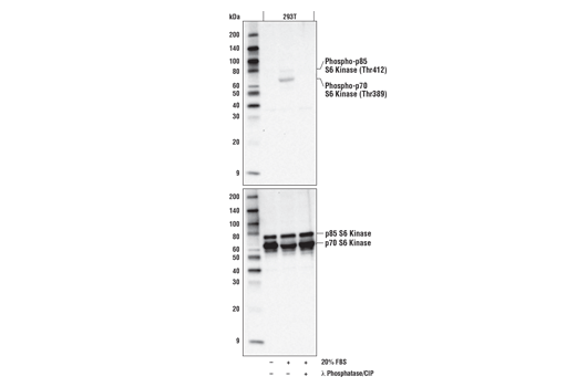 Phospho-p70 S6 Kinase (Thr389) (D5U1O) Rabbit mAb | Cell