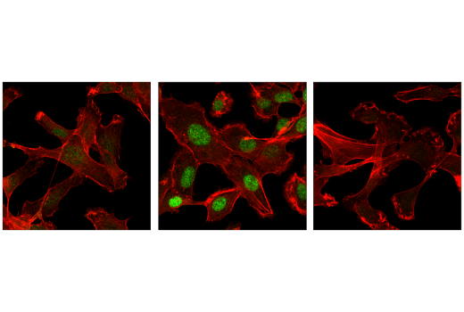 Immunofluorescence Image 1: Phospho-SMAD2 (Ser465/Ser467) (E8F3R) Rabbit Monoclonal Antibody