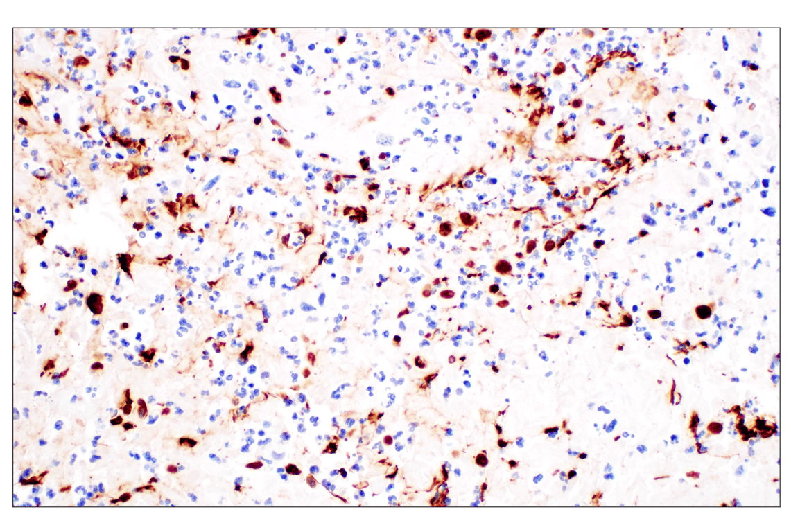 Immunohistochemistry Image 3: Citrullinated Histone H3 (Arg2) (F3C9B) Rabbit Monoclonal Antibody (BSA and Azide Free)