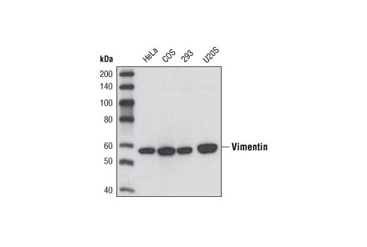 Western Blotting Image 2: Vimentin (5G3F10) Mouse Monoclonal Antibody
