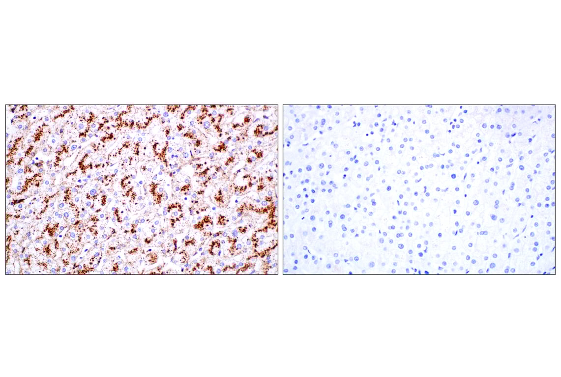 undefined Image 47: Genetics of Parkinson's Disease: Lysosomal Dysfunction Antibody Sampler Kit