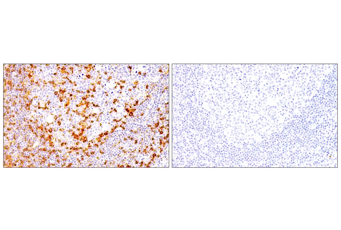 Immunohistochemistry Image 9: CD62L/L-Selectin (E7X9I) Rabbit Monoclonal Antibody (BSA and Azide Free)