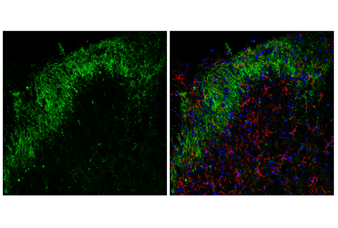 Immunofluorescence Image 3: Somatostatin (F8W1R) Rabbit Monoclonal Antibody