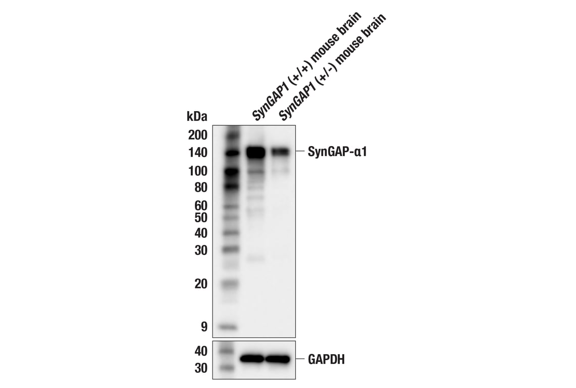 Western Blotting Image 2: SynGAP-alpha1 (F8I5Q) Rabbit Monoclonal Antibody