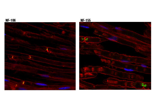 Immunofluorescence Image 1: Neurofascin 155 (D7B6O) Rabbit Monoclonal Antibody (BSA and Azide Free)