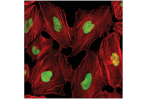 Immunofluorescence Image 1: G9a/EHMT2 (D5R4R) Rabbit Monoclonal Antibody