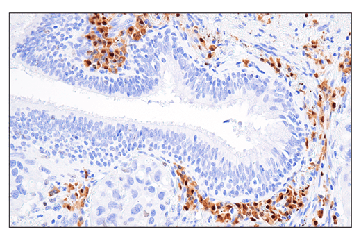 Immunohistochemistry Image 1: IRF-4 (E8H3S) XP<sup>®</sup> Rabbit mAb