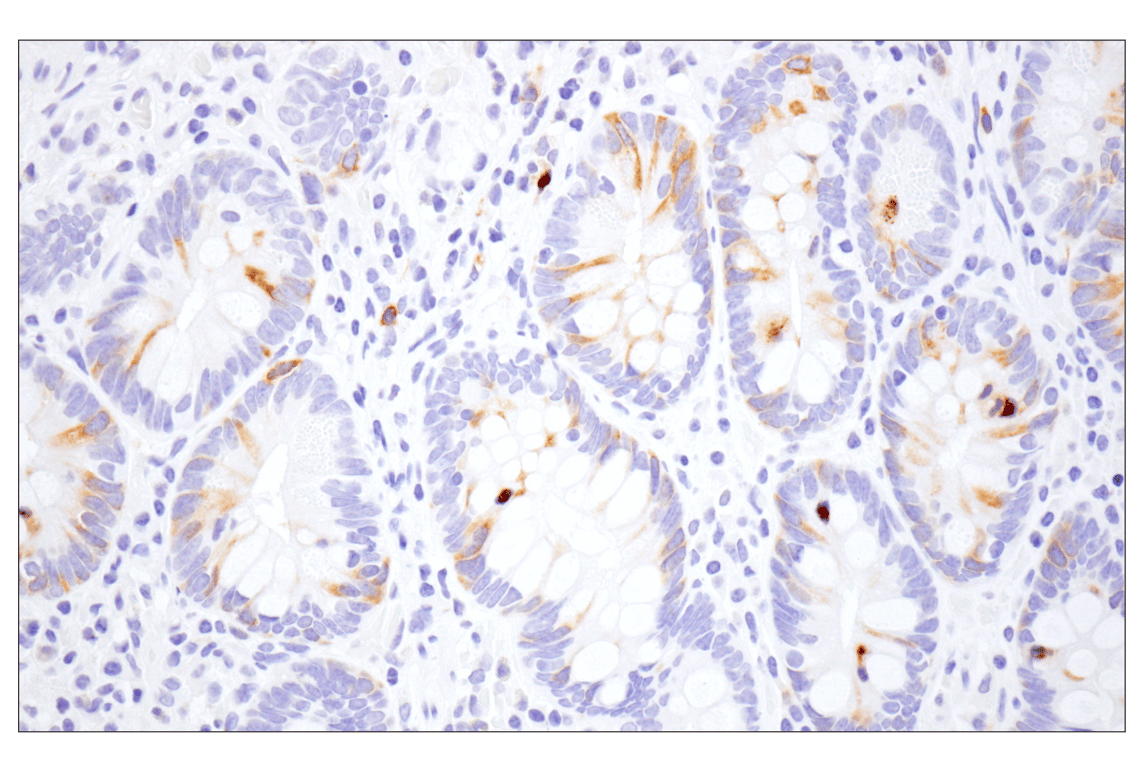 Immunohistochemistry Image 7: Eg5 (E1L3W) Rabbit Monoclonal Antibody