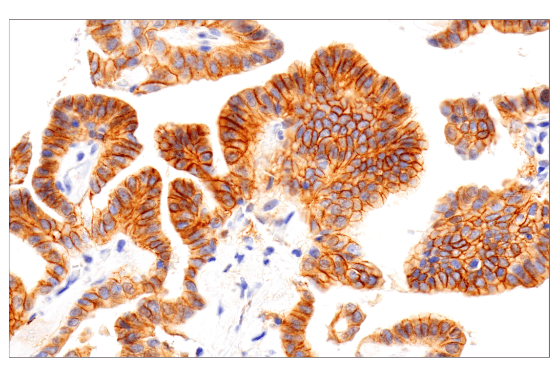 Immunohistochemistry Image 4: Notch2 (D76A6) Rabbit Monoclonal Antibody