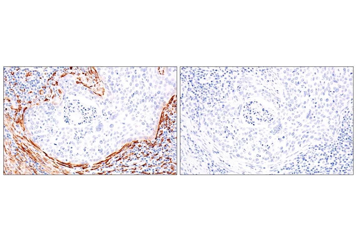 Immunohistochemistry Image 6: HSP47/SERPINH1 (E4A8P) Rabbit Monoclonal Antibody