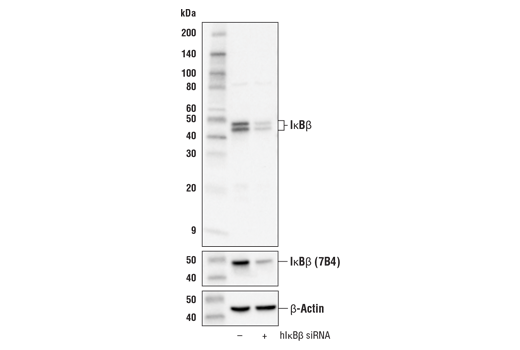 IkB beta Antibody (D1T3Z) | Cell Signaling Technology