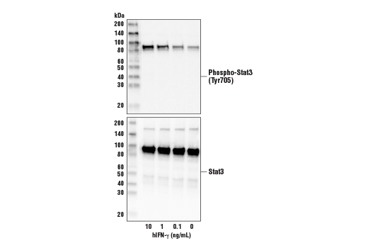 undefined Image 3: Human Interferon-gamma (hIFN-gamma) Recombinant Protein