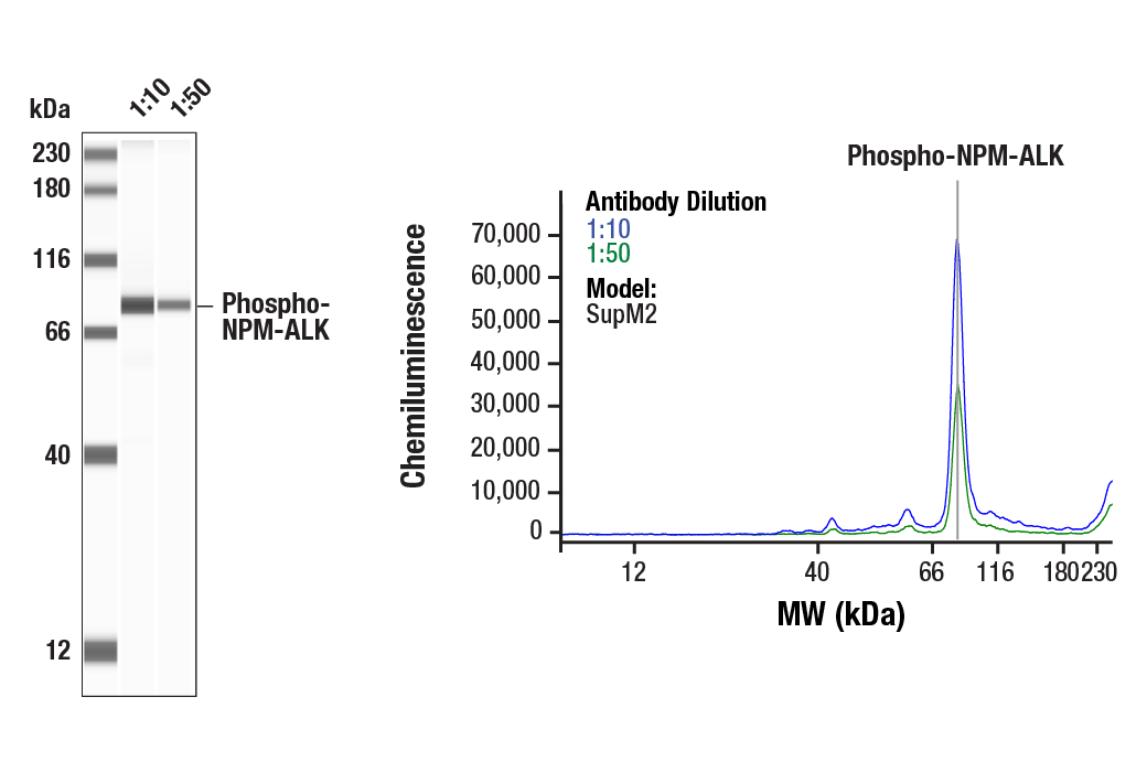 Western Blotting Image 1: Phospho-ALK (Tyr1604) Antibody