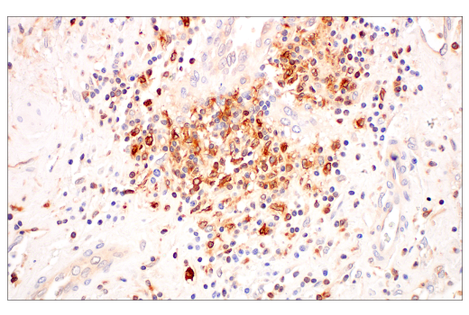 Immunohistochemistry Image 6: c-Rel (E8Z5Y) Rabbit Monoclonal Antibody (BSA and Azide Free)