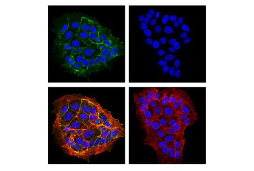 Immunofluorescence Image 1: Occludin (E6B4R) Rabbit Monoclonal Antibody (BSA and Azide Free)