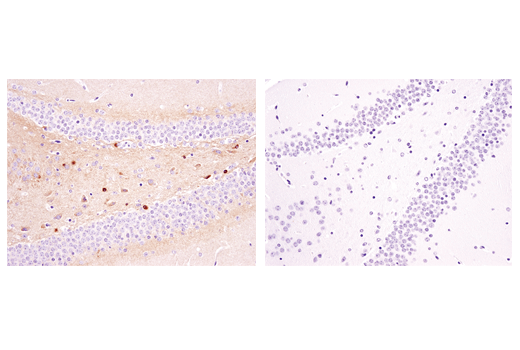 Immunohistochemistry Image 4: Phospho-Tau (Ser404) (D2Z4G) Rabbit Monoclonal Antibody (IHC/IF Formulated)