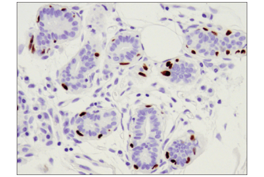 Immunohistochemistry Image 1: p63 (D9L7L) Rabbit Monoclonal Antibody