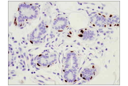 Immunohistochemistry Image 1: p63 (D9L7L) XP<sup>®</sup> Rabbit mAb