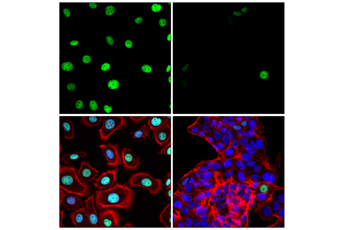Immunofluorescence Image 1: p63 (D9L7L) Rabbit Monoclonal Antibody