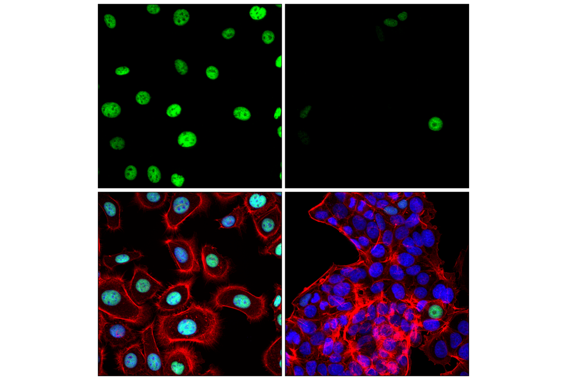 Immunofluorescence Image 1: p63 (D9L7L) XP<sup>®</sup> Rabbit mAb