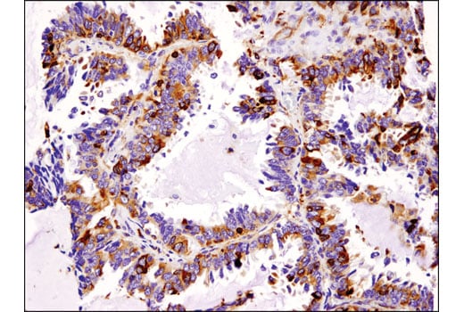 Immunohistochemistry Image 3: Stathmin (D1Y5A) Rabbit Monoclonal Antibody