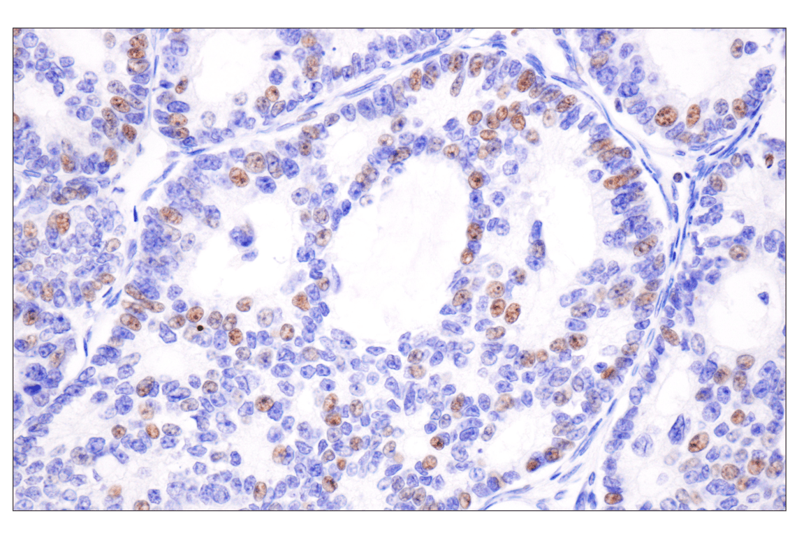Immunohistochemistry Image 3: Acetyl-Histone H4 (Lys16) (E2B8W) Rabbit Monoclonal Antibody
