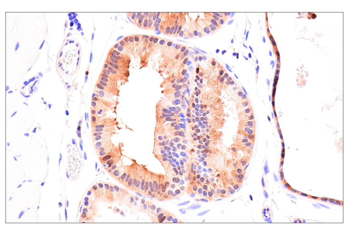 Immunohistochemistry Image 11: CDK6 (E3E3Q) Rabbit Monoclonal Antibody