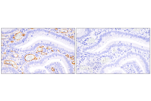 undefined Image 79: Pericyte Antibody Sampler Kit