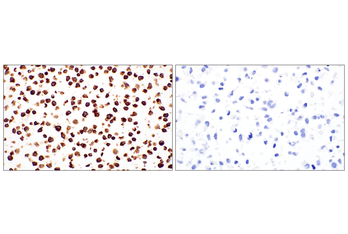 Immunohistochemistry Image 10: CD34 (QBEND/10) Mouse Monoclonal Antibody