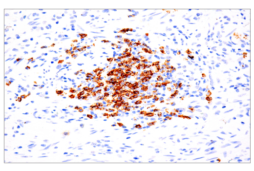 Immunohistochemistry Image 4: CD20 (L26) Mouse Monoclonal Antibody