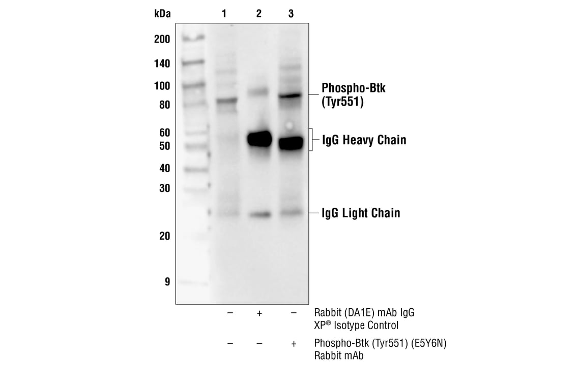 Immunoprecipitation Image 1: Phospho-Btk (Tyr551) (E5Y6N) Rabbit Monoclonal Antibody